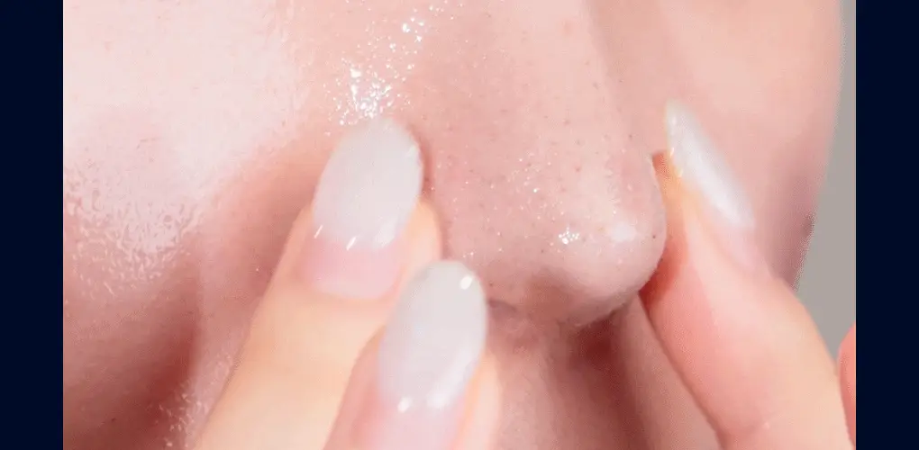 [블랙헤드관리/김다혜PICK] 비프로젝트 바이 블랙헤드 멜팅 리무버 30ml 상세페이지 32